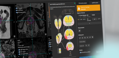 quantib detection cancer de la prostate clinique saint-jean